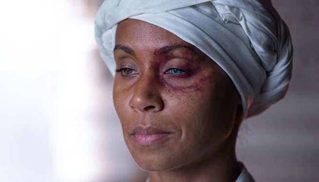 fish-mooney-eye